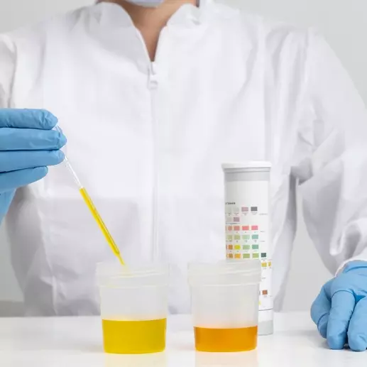 доктор проводит анализ мочи на микроэлементы